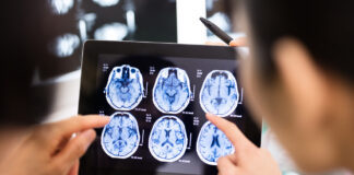 脳・心臓疾患の労災認定基準が改正されました!